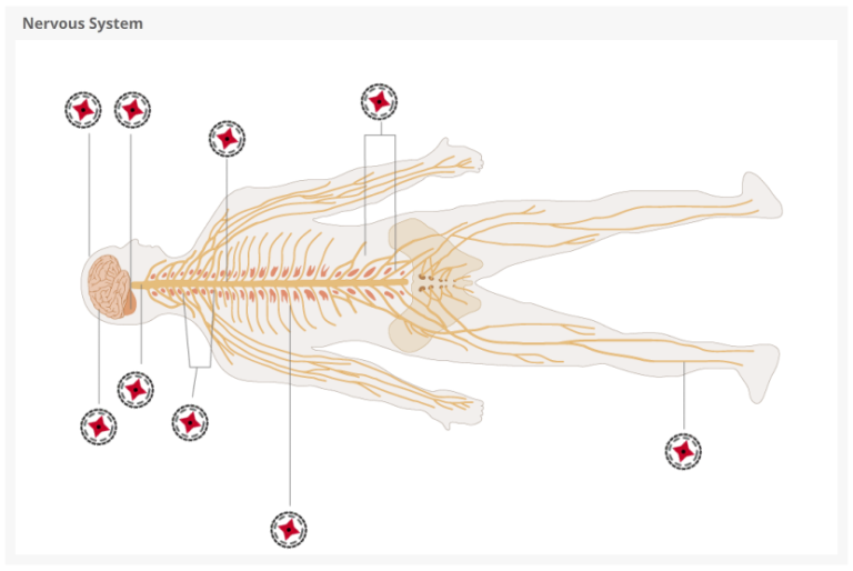 Nervous System